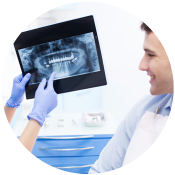 Dental X-Rays | Affordable X-Ray Plans | Forbes Dental Care